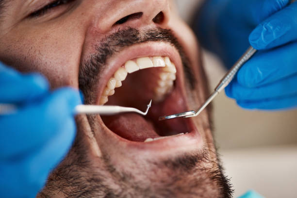 Best Emergency Dental Care for Broken or Chipped Teeth in Plumas Lake, CA